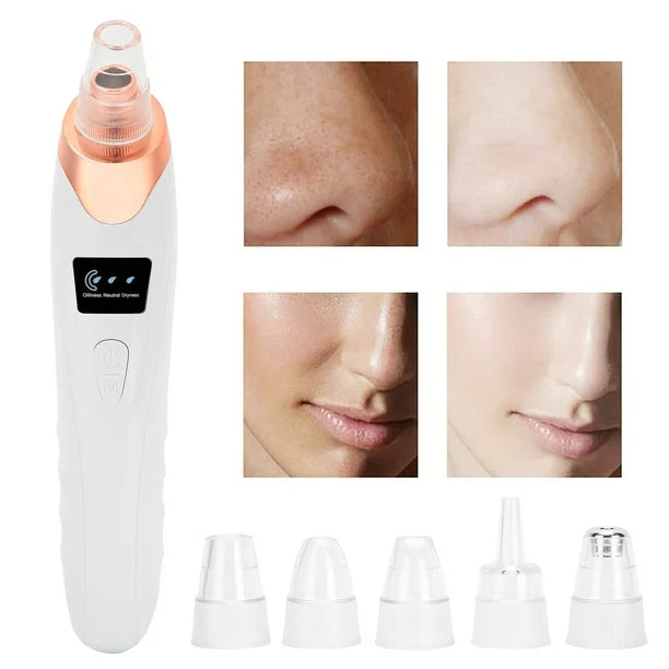 LuxeFace® - Succionador facial de espinillas