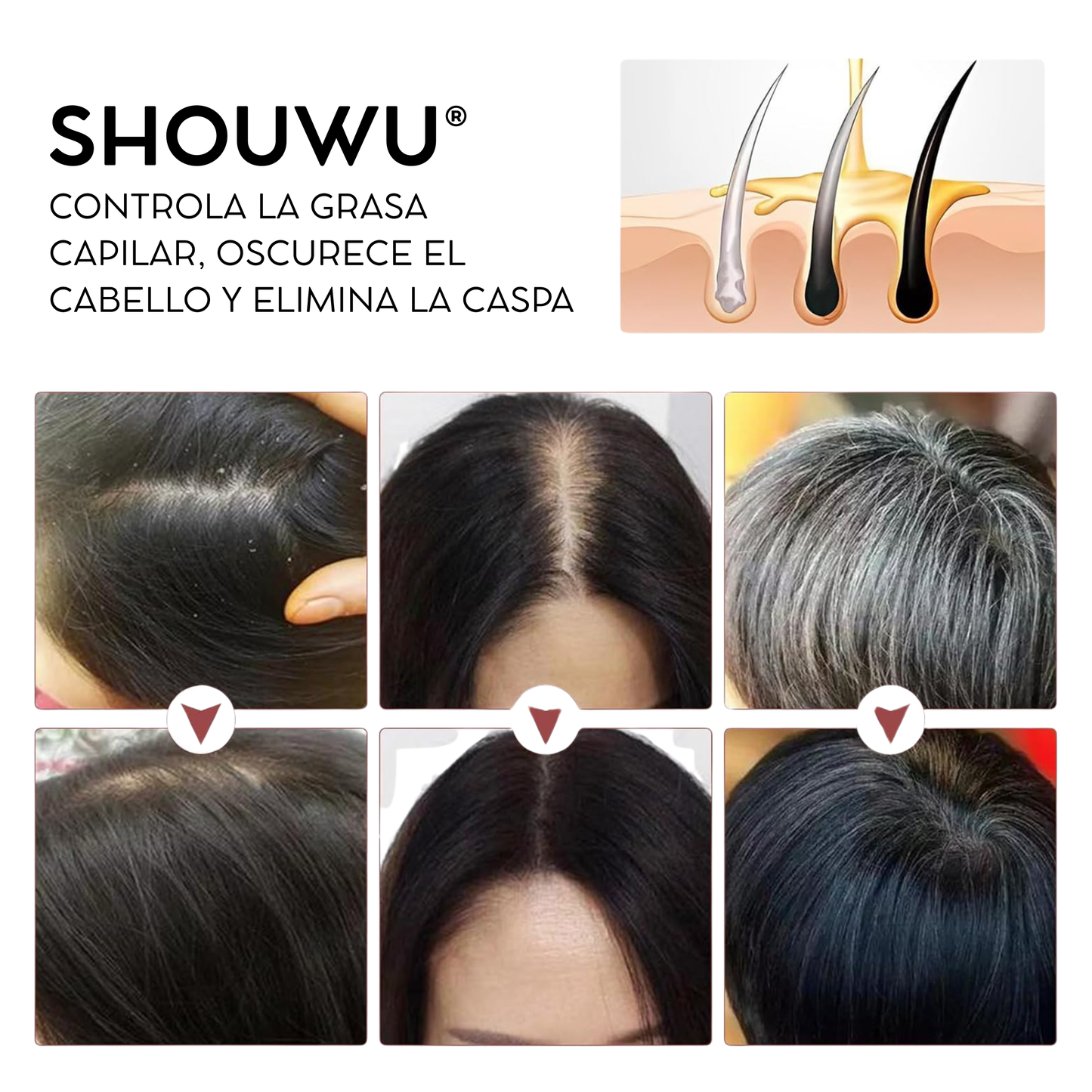 Shouwu® 3x1 - Jabón de polygonum para el cabello