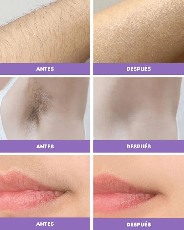 DepiLux™ – Depiladora Portátil Recargable con Luz LED